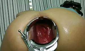 speculum gusenyuka h ...
